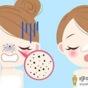 恼人的草莓鼻 教你有效更快祛除黑头的秘籍