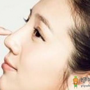 隆鼻术后出现肿胀该怎么办