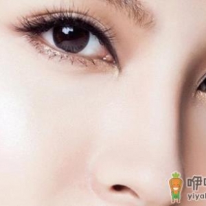 韩式开眼角 唯美打造无敌电眼