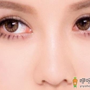 告诉你双眼皮贴的使用技巧