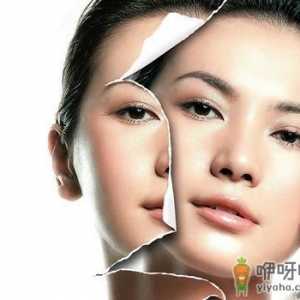 注射美白针美白有哪些误区