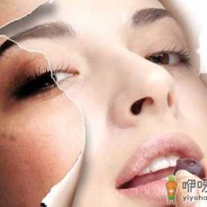 天然无刺激的祛痘小妙招 帮你赶跑痘痘