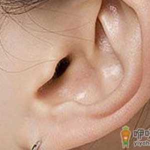 5种耳部畸形需要做整形