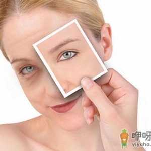 如何去除肿眼泡及后遗症