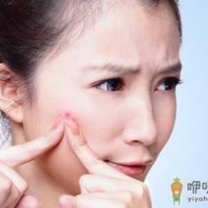 脸长痘痘迟迟不消 小心粉瘤来袭