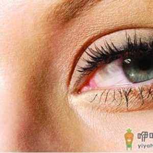 怎么去眼袋 选对方法是关键