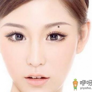 激光能够去除3种类型的痣
