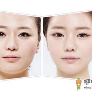 女生脸部皮肤松弛怎么办