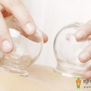 拔罐减肥要注意哪些问题