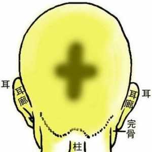 骨相图解：金锁十字骨