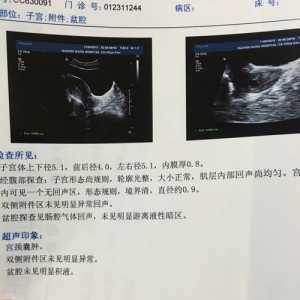 宫颈囊肿是怎么回事(宫颈囊肿是怎么回事需要治疗吗)