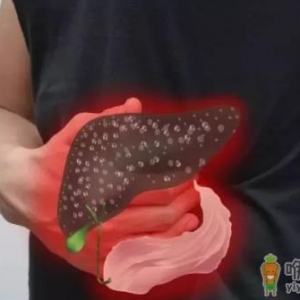 治疗黄疸型肝炎的9则小偏方 能有效治疗黄疸型肝炎