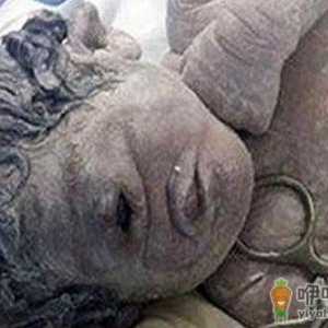 埃及孕妇遭辐射 产下独眼男婴