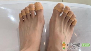 灰指甲说明身体哪里不好