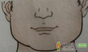 人中上的痣能去掉吗
