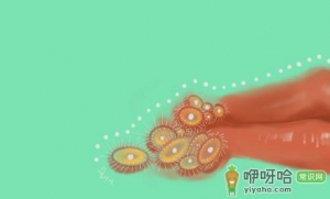 女性为什么会得口唇疱疹