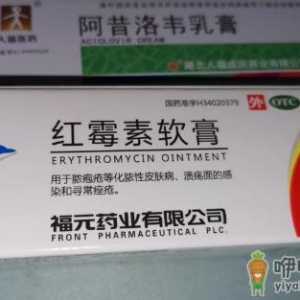 生殖疱疹其实没那么严重真的假的