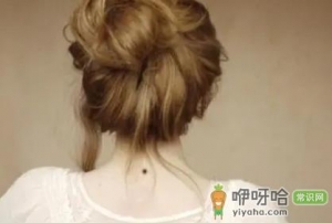 嘴巴下的痣可以去掉吗
