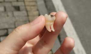 拔了一颗大牙后悔死了什么说法