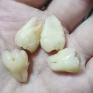 为什么有的牙齿有2个牙根有的没有