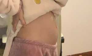 为什么有的人孕吐有的人不孕吐