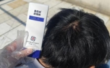 魔术丝能治秃顶吗